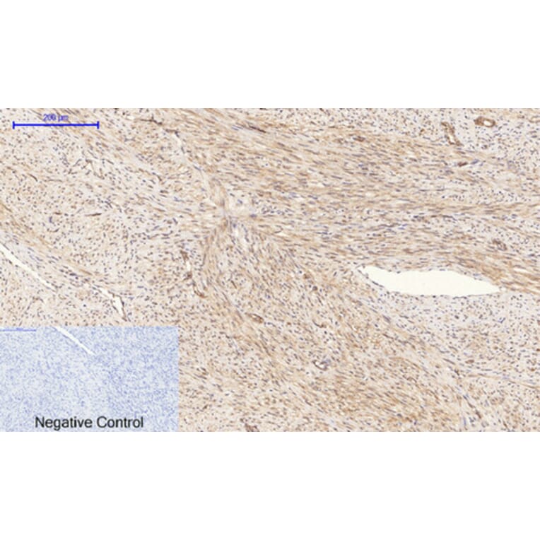 Immunohistochemistry - Anti-PI 3 Kinase p85 alpha + Gamma (phospho Tyr467 + Tyr199) Antibody (A1224) - Antibodies.com