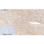 Immunohistochemistry - Anti-PI 3 Kinase p85 alpha + Gamma (phospho Tyr467 + Tyr199) Antibody (A1224) - Antibodies.com