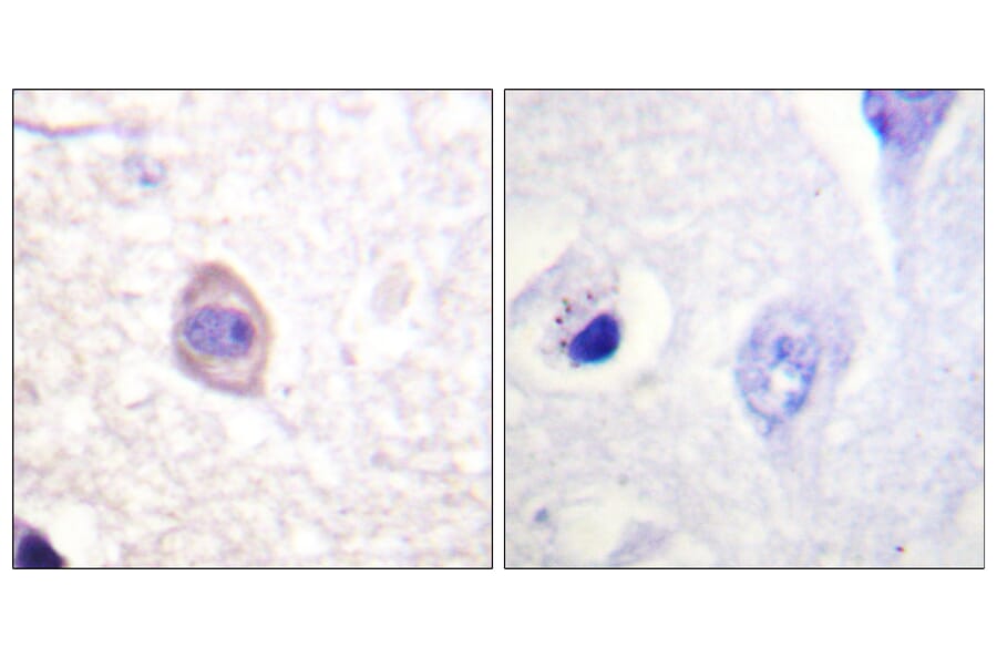 Immunohistochemistry - Anti-Interferon-gamma Receptor alpha (phospho Tyr457) Antibody (A0953) - Antibodies.com