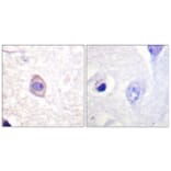 Immunohistochemistry - Anti-Interferon-gamma Receptor alpha (phospho Tyr457) Antibody (A0953) - Antibodies.com
