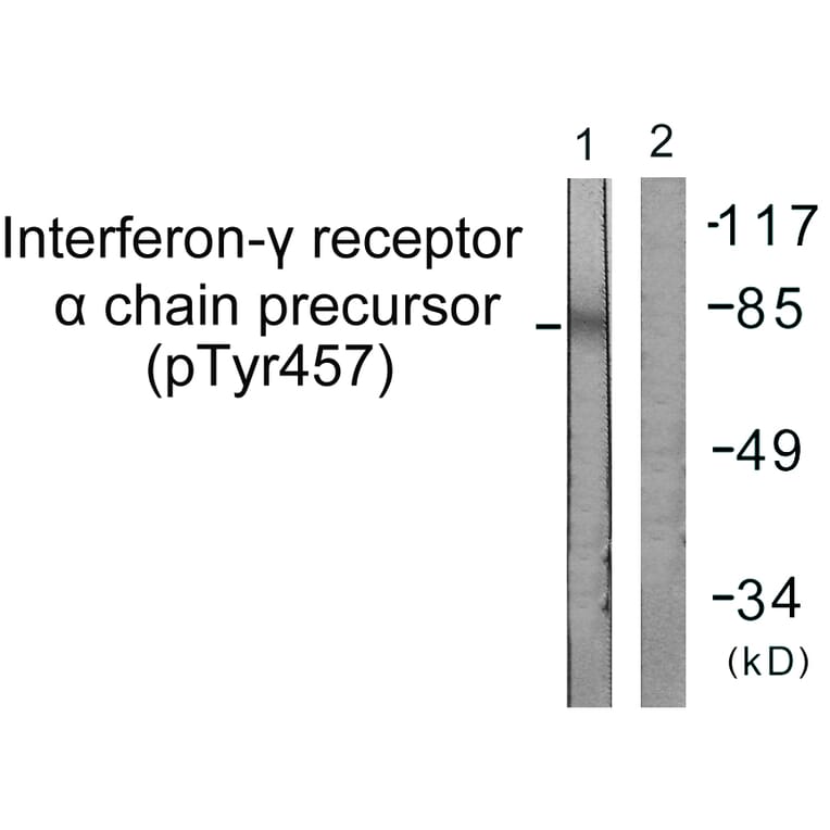 Western Blot - Anti-Interferon-gamma Receptor alpha (phospho Tyr457) Antibody (A0953) - Antibodies.com