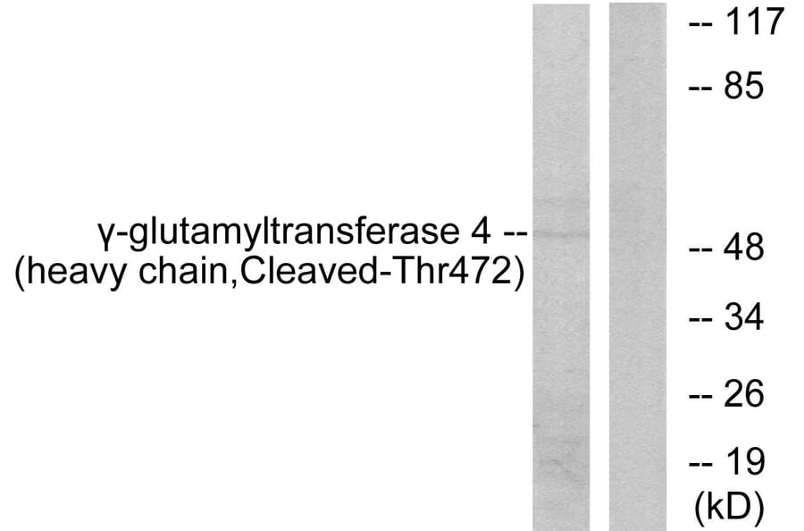 Western Blot - Anti-Gamma-glutamyltransferase 4 (heavy chain, cleaved Thr472) Antibody (L0266) - Antibodies.com