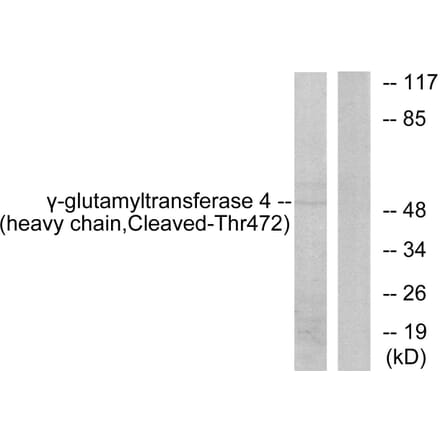 Western Blot - Anti-Gamma-glutamyltransferase 4 (heavy chain, cleaved Thr472) Antibody (L0266) - Antibodies.com