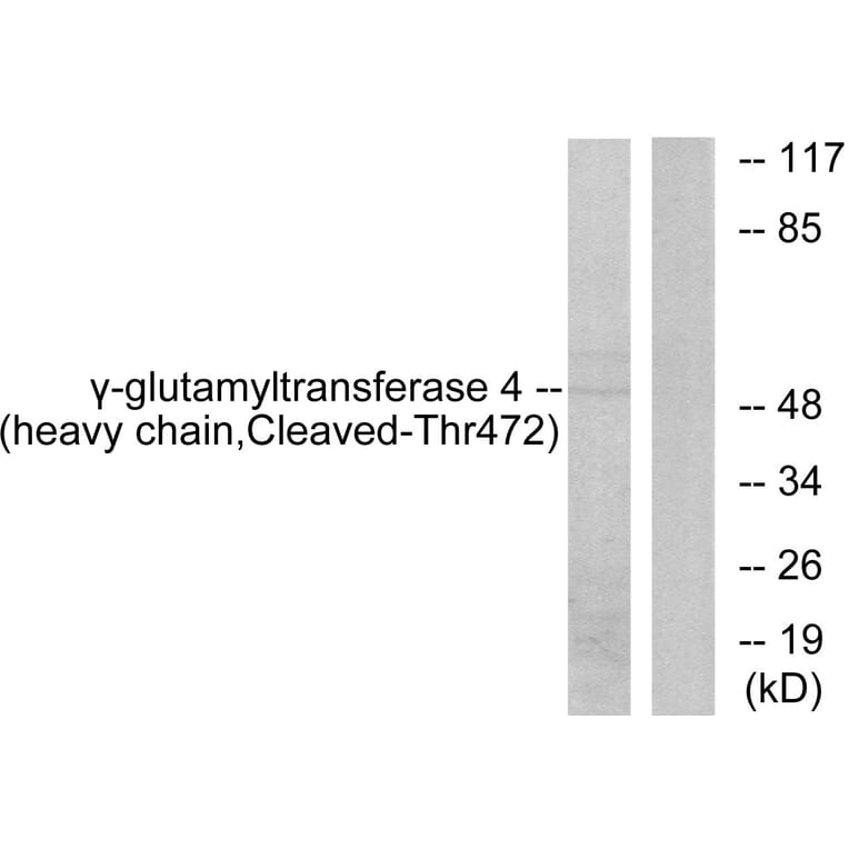 Western Blot - Anti-Gamma-glutamyltransferase 4 (heavy chain, cleaved Thr472) Antibody (L0266) - Antibodies.com