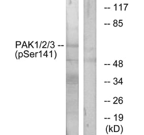 Western Blot - Anti-PAK1 + PAK2 + PAK3 (phospho Ser144 + Ser141 +Ser139) Antibody (A0541) - Antibodies.com