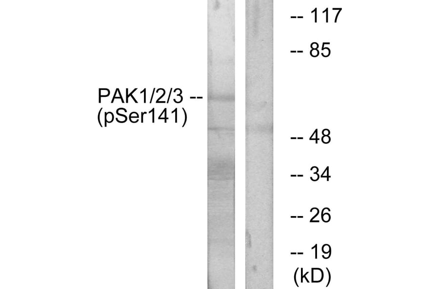 Western Blot - Anti-PAK1 + PAK2 + PAK3 (phospho Ser144 + Ser141 +Ser139) Antibody (A0541) - Antibodies.com