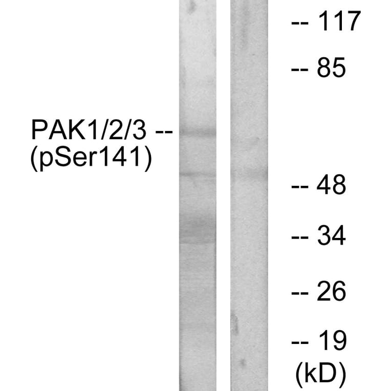 Western Blot - Anti-PAK1 + PAK2 + PAK3 (phospho Ser144 + Ser141 +Ser139) Antibody (A0541) - Antibodies.com