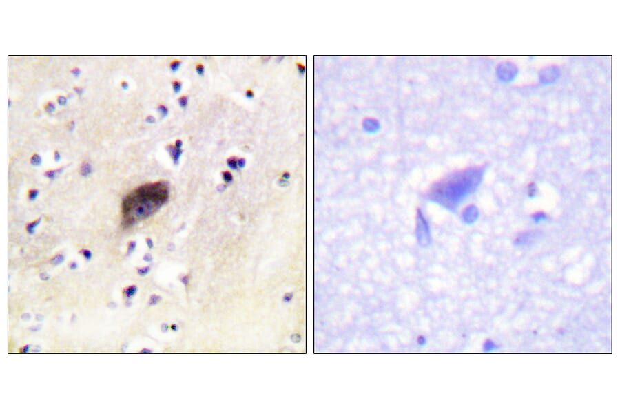 Immunohistochemistry - Anti-PAK1 + PAK2 + PAK3 (phospho Ser144 + Ser141 +Ser139) Antibody (A0541) - Antibodies.com