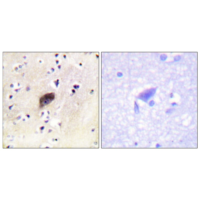Immunohistochemistry - Anti-PAK1 + PAK2 + PAK3 (phospho Ser144 + Ser141 +Ser139) Antibody (A0541) - Antibodies.com