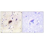 Immunohistochemistry - Anti-PAK1 + PAK2 + PAK3 (phospho Ser144 + Ser141 +Ser139) Antibody (A0541) - Antibodies.com