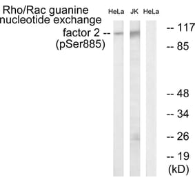 Western Blot - Anti-Rac Guanine Nucleotide Exchange Factor 2 (phospho Ser885) Antibody (A1233) - Antibodies.com