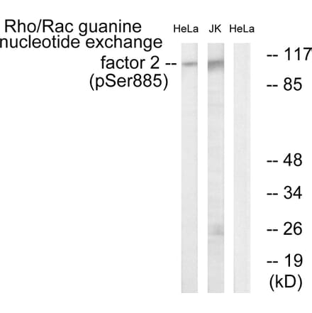 Western Blot - Anti-Rac Guanine Nucleotide Exchange Factor 2 (phospho Ser885) Antibody (A1233) - Antibodies.com