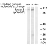 Western Blot - Anti-Rac Guanine Nucleotide Exchange Factor 2 (phospho Ser885) Antibody (A1233) - Antibodies.com