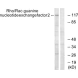 Western Blot - Anti-Rac Guanine Nucleotide Exchange Factor 2 Antibody (B1233) - Antibodies.com