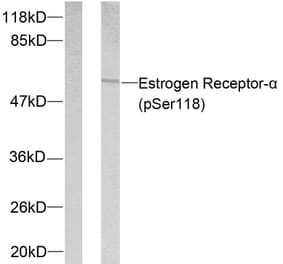 Western Blot - Anti-Estrogen Receptor-alpha (phospho Ser118) Antibody (A7077) - Antibodies.com