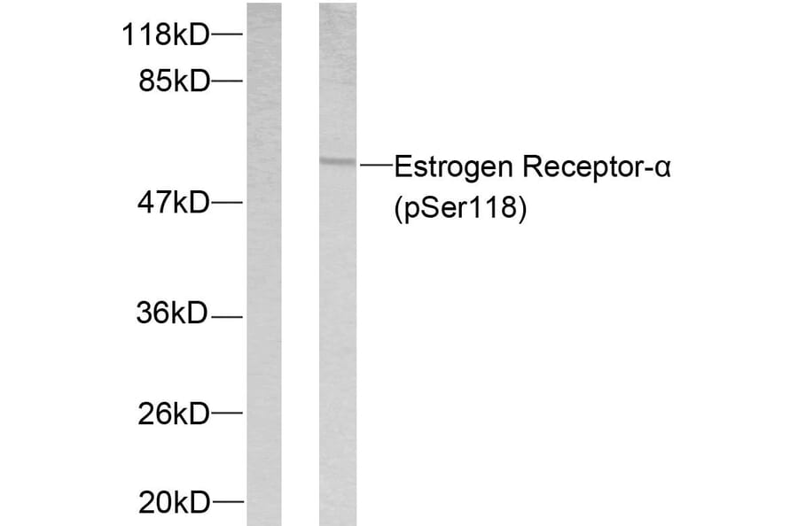 Western Blot - Anti-Estrogen Receptor-alpha (phospho Ser118) Antibody (A7077) - Antibodies.com