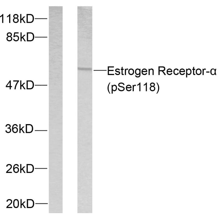 Western Blot - Anti-Estrogen Receptor-alpha (phospho Ser118) Antibody (A7077) - Antibodies.com