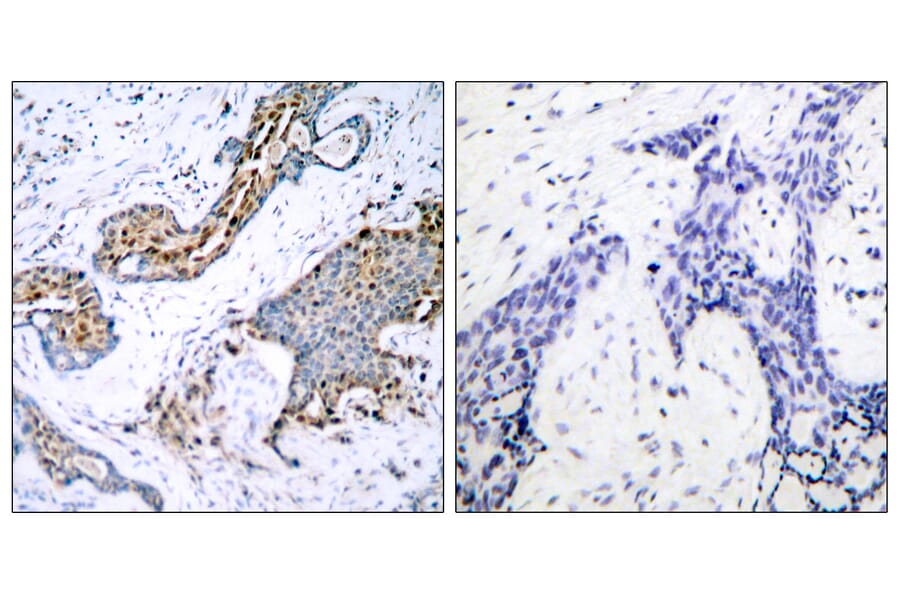 Immunohistochemistry - Anti-Estrogen Receptor-alpha (phospho Ser118) Antibody (A7077) - Antibodies.com