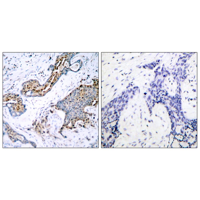 Immunohistochemistry - Anti-Estrogen Receptor-alpha (phospho Ser118) Antibody (A7077) - Antibodies.com