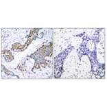 Immunohistochemistry - Anti-Estrogen Receptor-alpha (phospho Ser118) Antibody (A7077) - Antibodies.com