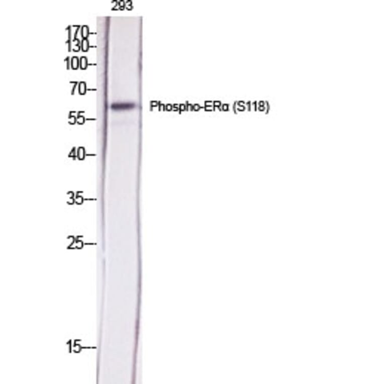 Western Blot - Anti-Estrogen Receptor-alpha (phospho Ser118) Antibody (A7077) - Antibodies.com