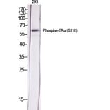 Western Blot - Anti-Estrogen Receptor-alpha (phospho Ser118) Antibody (A7077) - Antibodies.com