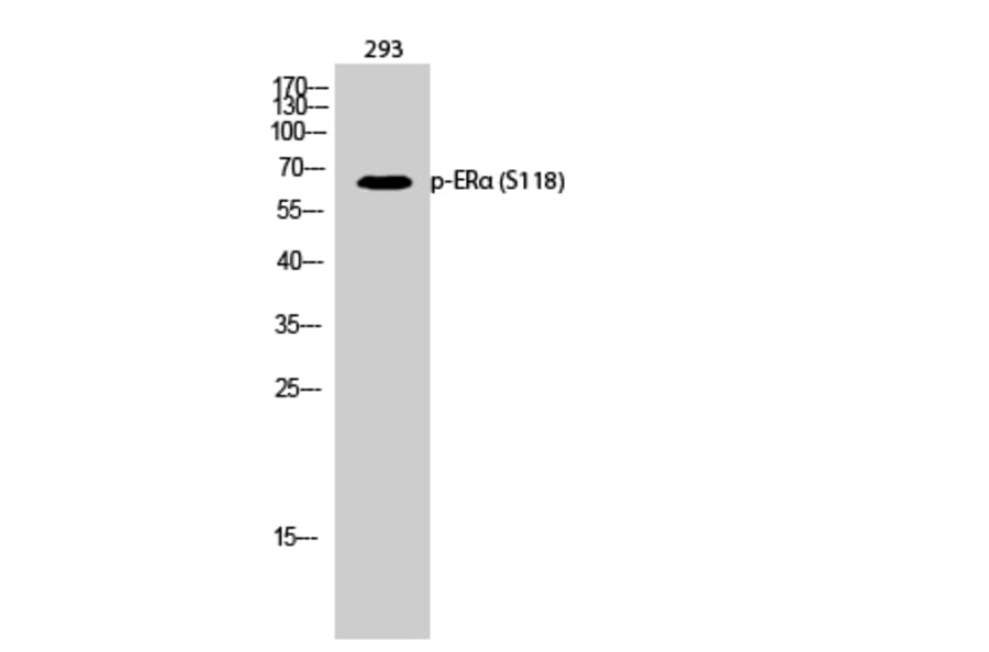 Western Blot - Anti-Estrogen Receptor-alpha (phospho Ser118) Antibody (A7077) - Antibodies.com
