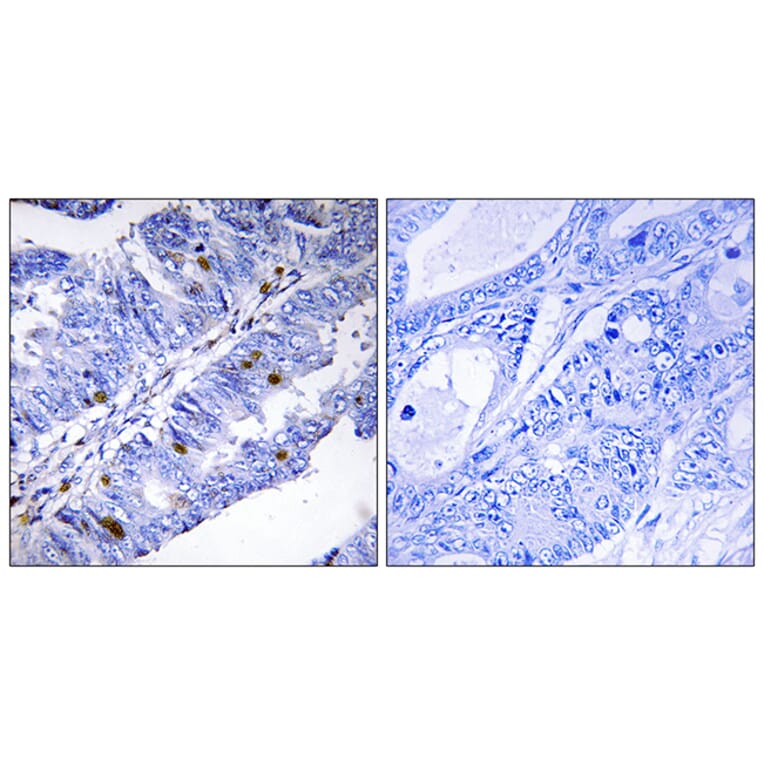 Immunohistochemistry - Anti-Nuclear Receptor NR4A1 (phospho Ser351) Antibody (A1168) - Antibodies.com