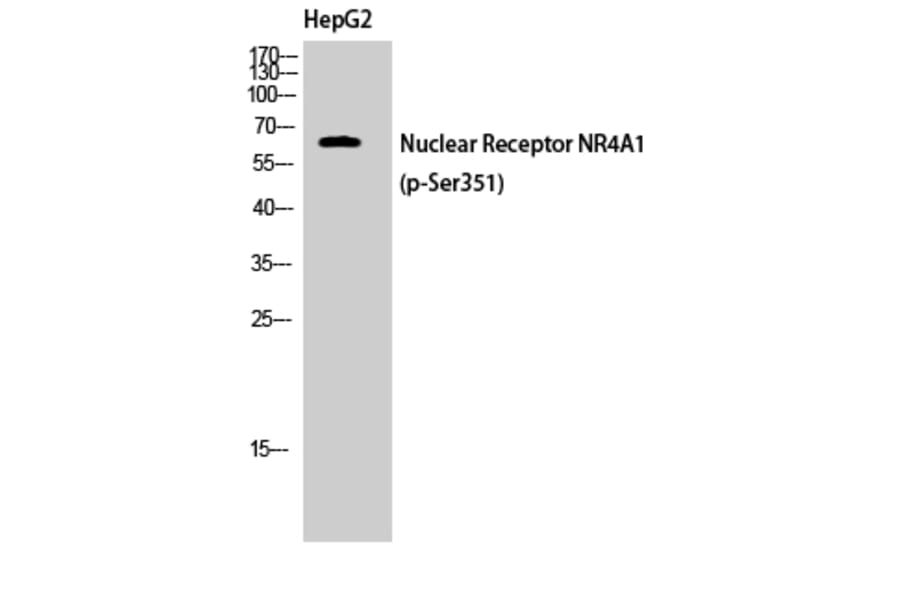 Western Blot - Anti-Nuclear Receptor NR4A1 (phospho Ser351) Antibody (A1168) - Antibodies.com