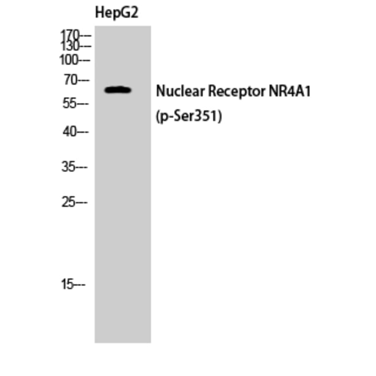 Western Blot - Anti-Nuclear Receptor NR4A1 (phospho Ser351) Antibody (A1168) - Antibodies.com