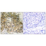 Immunohistochemistry - Anti-Integrin beta1 (phospho Thr789) Antibody (A0491) - Antibodies.com