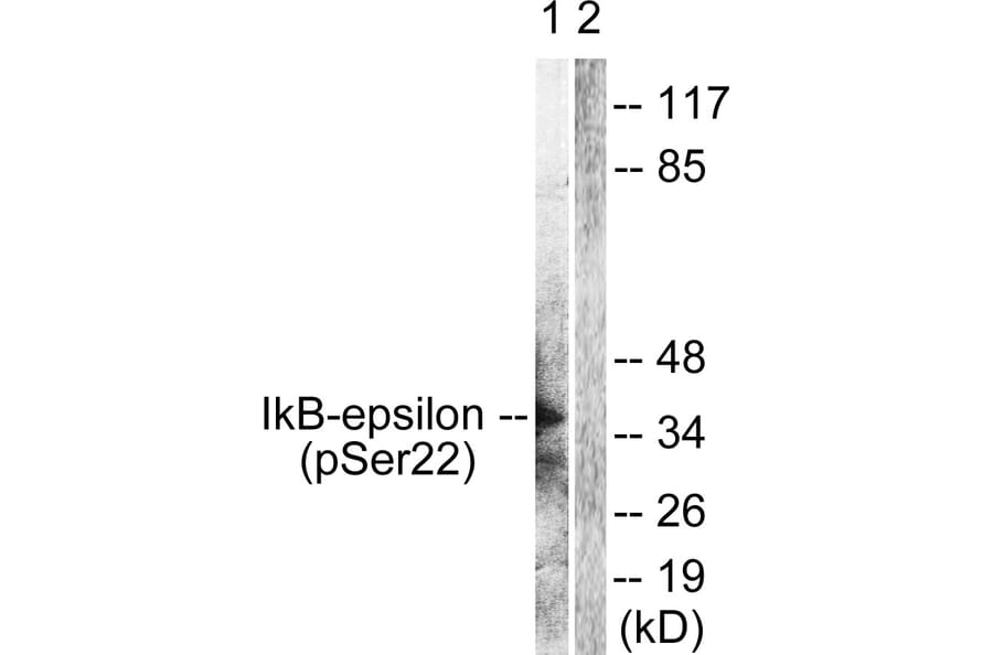 Western Blot - Anti-IkappaB-epsilon (phospho Ser22) Antibody (A0015) - Antibodies.com