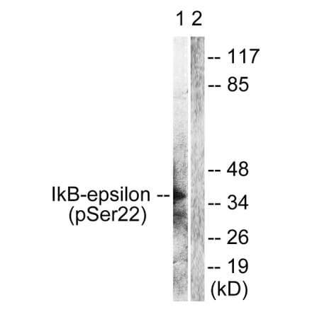 Western Blot - Anti-IkappaB-epsilon (phospho Ser22) Antibody (A0015) - Antibodies.com