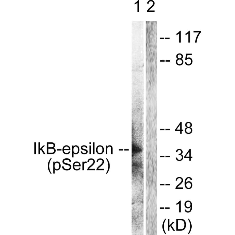 Western Blot - Anti-IkappaB-epsilon (phospho Ser22) Antibody (A0015) - Antibodies.com