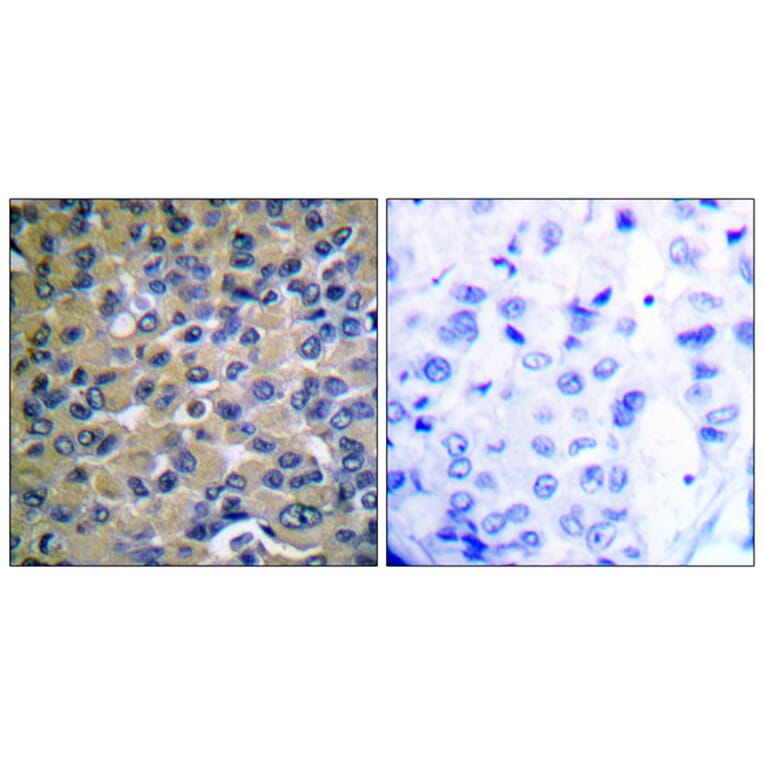 Immunohistochemistry - Anti-IkappaB-epsilon (phospho Ser22) Antibody (A0015) - Antibodies.com