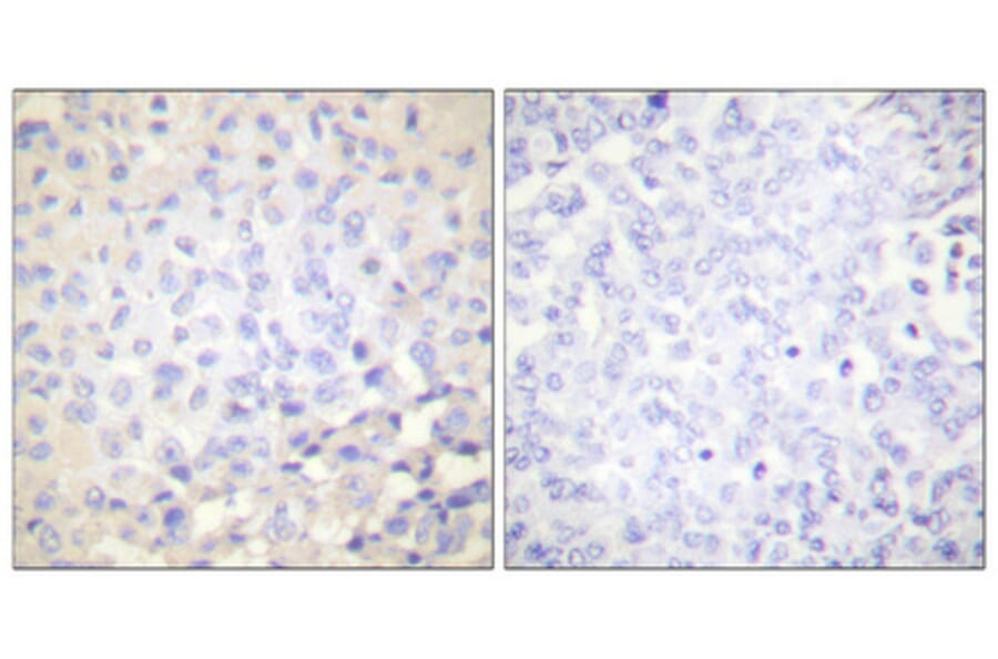 Immunohistochemistry - Anti-IkappaB-epsilon (phospho Ser22) Antibody (A0015) - Antibodies.com
