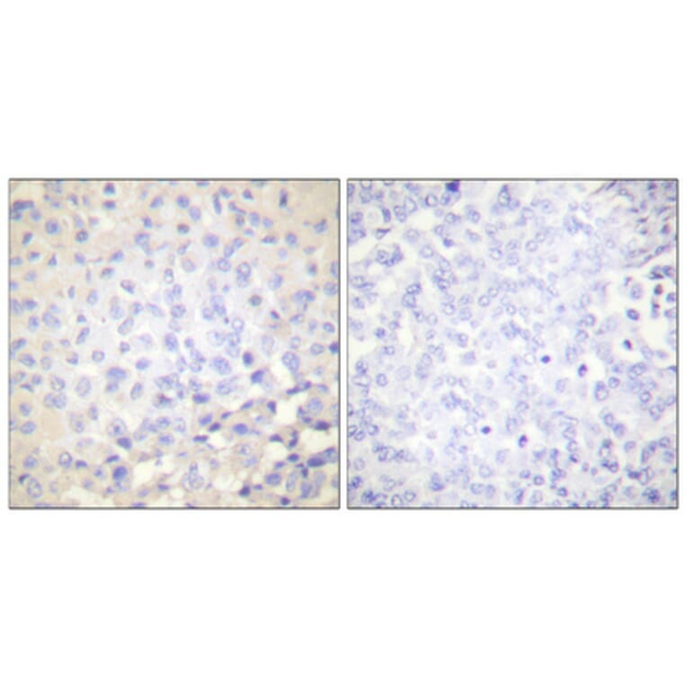 Immunohistochemistry - Anti-IkappaB-epsilon (phospho Ser22) Antibody (A0015) - Antibodies.com