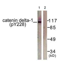 Western Blot - Anti-Catenin-delta1 (phospho Tyr228) Antibody (A0891) - Antibodies.com