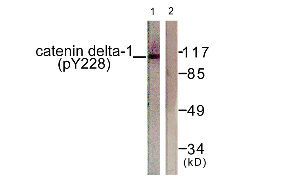 Western Blot - Anti-Catenin-delta1 (phospho Tyr228) Antibody (A0891) - Antibodies.com