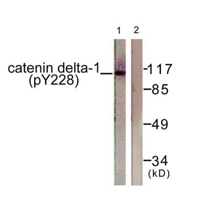 Western Blot - Anti-Catenin-delta1 (phospho Tyr228) Antibody (A0891) - Antibodies.com