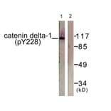 Western Blot - Anti-Catenin-delta1 (phospho Tyr228) Antibody (A0891) - Antibodies.com