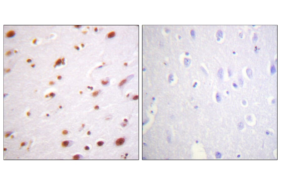 Immunohistochemistry - Anti-Catenin-delta1 (phospho Tyr228) Antibody (A0891) - Antibodies.com