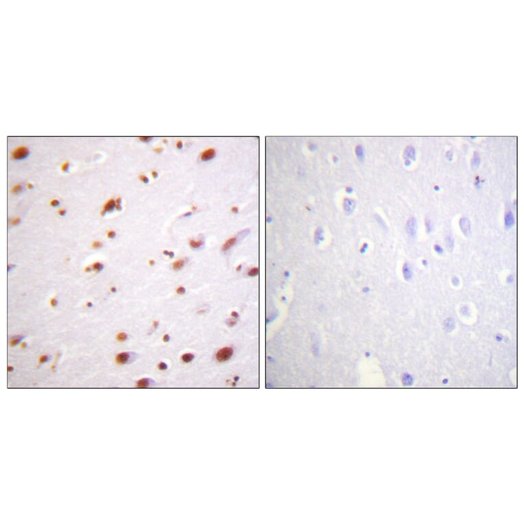 Immunohistochemistry - Anti-Catenin-delta1 (phospho Tyr228) Antibody (A0891) - Antibodies.com