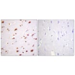 Immunohistochemistry - Anti-Catenin-delta1 (phospho Tyr228) Antibody (A0891) - Antibodies.com