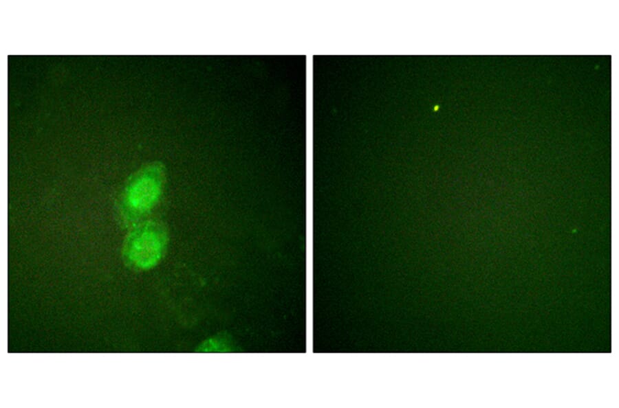 Immunofluorescence - Anti-Catenin-delta1 (phospho Tyr228) Antibody (A0891) - Antibodies.com