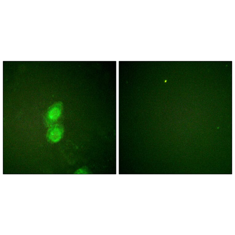 Immunofluorescence - Anti-Catenin-delta1 (phospho Tyr228) Antibody (A0891) - Antibodies.com