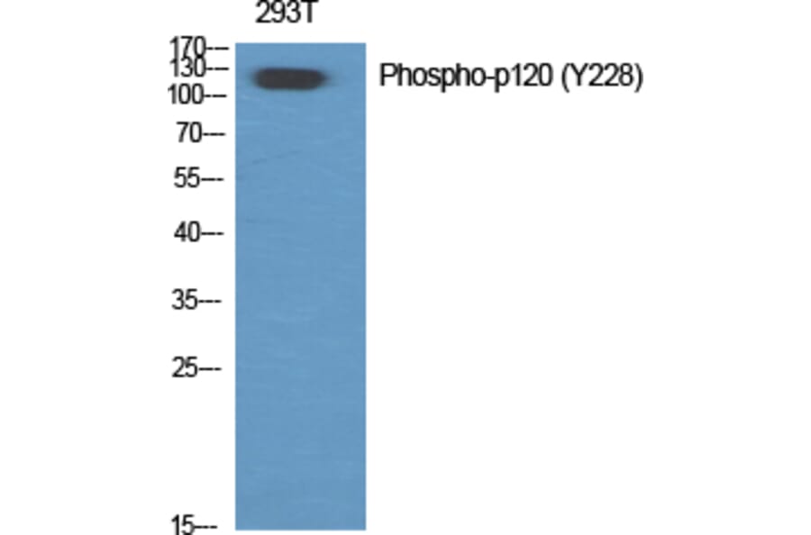Western Blot - Anti-Catenin-delta1 (phospho Tyr228) Antibody (A0891) - Antibodies.com