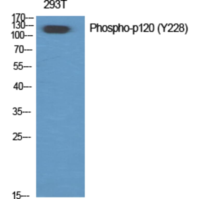 Western Blot - Anti-Catenin-delta1 (phospho Tyr228) Antibody (A0891) - Antibodies.com