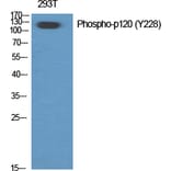 Western Blot - Anti-Catenin-delta1 (phospho Tyr228) Antibody (A0891) - Antibodies.com