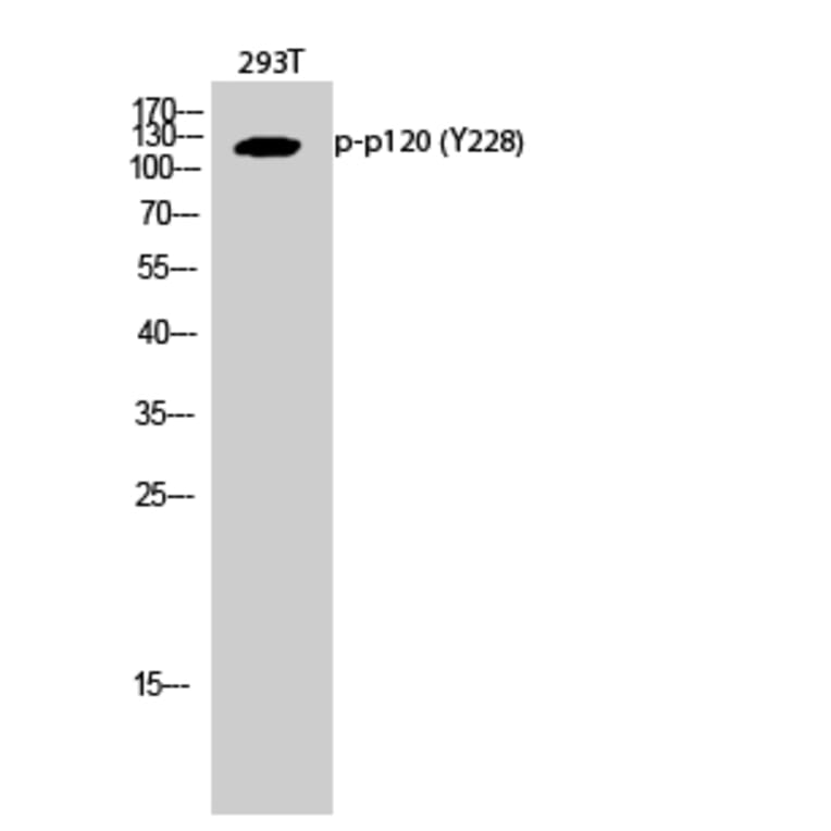 Western Blot - Anti-Catenin-delta1 (phospho Tyr228) Antibody (A0891) - Antibodies.com